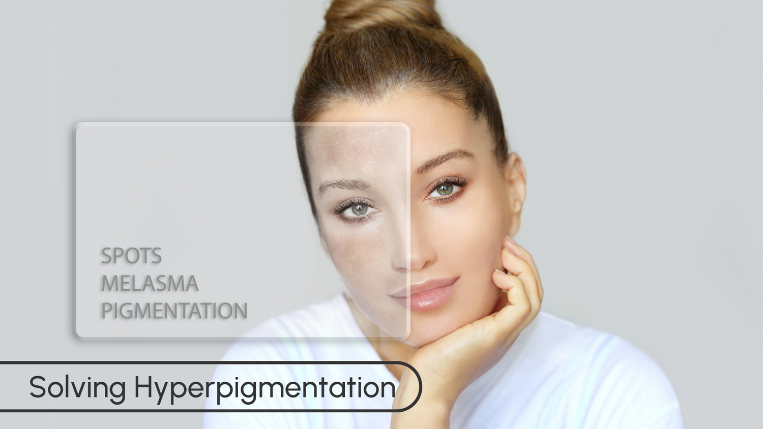 hyperpigmentation exosome skincare solution