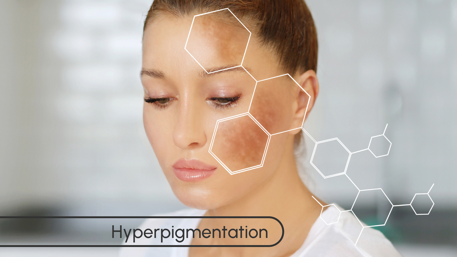 skinhealth uneven skintone hyperpigmentation redness melasma solution peptides